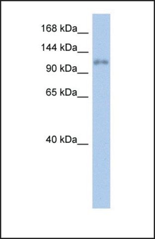 Anti-ZNF217, (N-terminal) antibody produced in rabbit