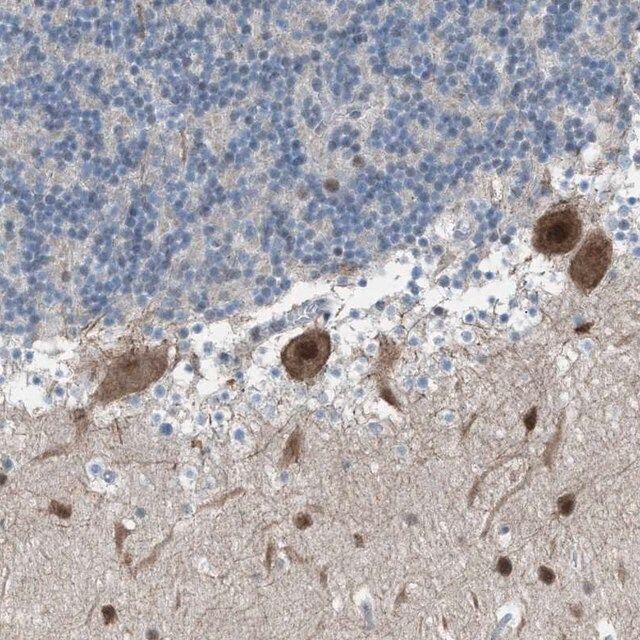 Anti-ZNF276 antibody produced in rabbit