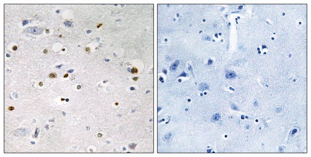 Anti-ZNF7, N-Terminal antibody produced in rabbit