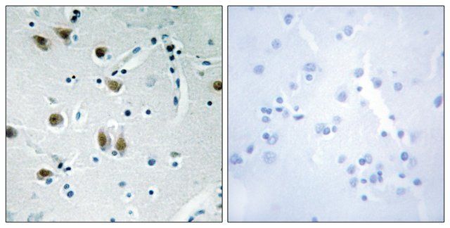 Anti-ZNF148, N-Terminal antibody produced in rabbit