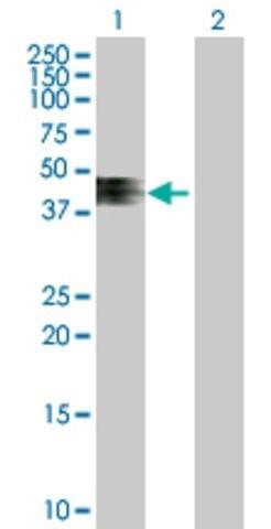 Anti-ZNRF4 antibody produced in mouse