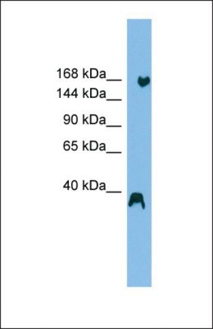 Anti-ZNF294, (N-terminal) antibody produced in rabbit