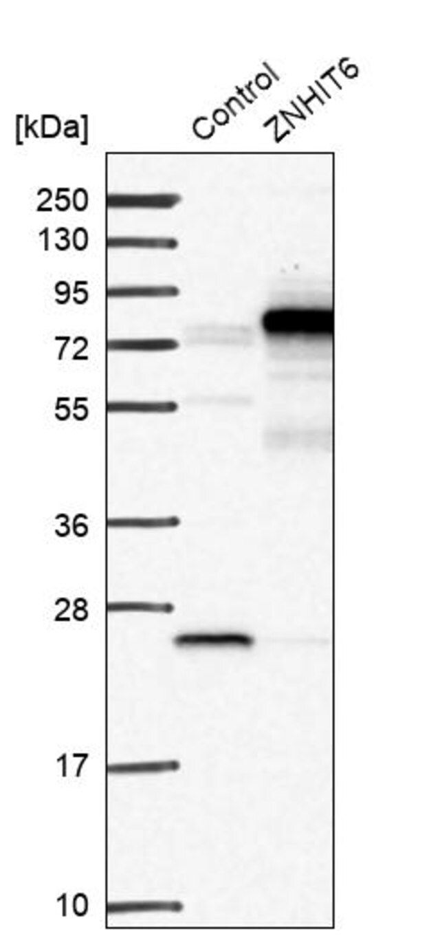 Anti-ZNHIT6 antibody produced in rabbit