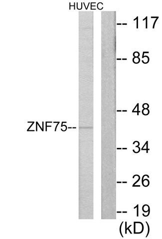 Anti-ZNF75, C-Terminal antibody produced in rabbit