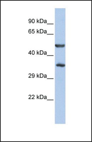 Anti-ZNF414, (N-terminal) antibody produced in rabbit