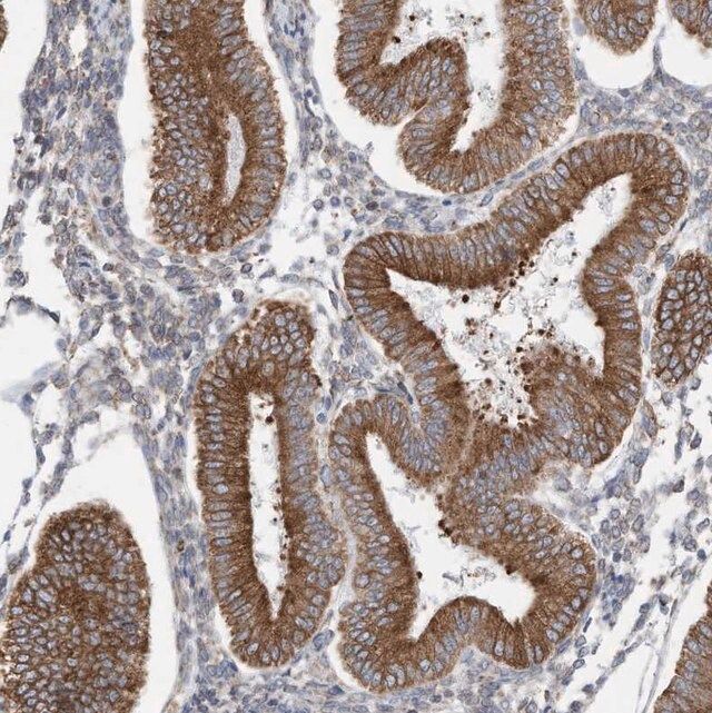 Anti-ZNF354C antibody produced in rabbit