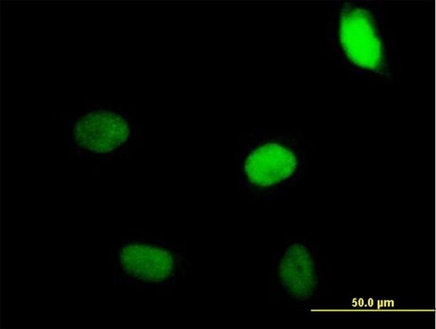 Anti-ZNF35, (N-terminal) antibody produced in mouse