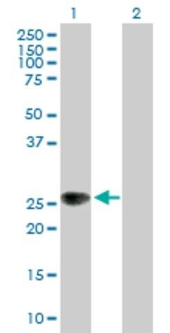 Anti-ZNRF1 antibody produced in mouse