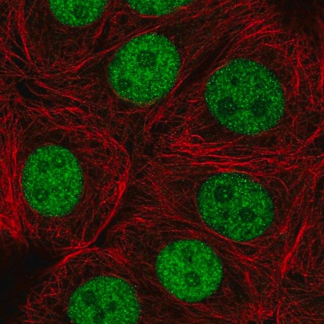 Anti-ZRANB2 antibody produced in rabbit