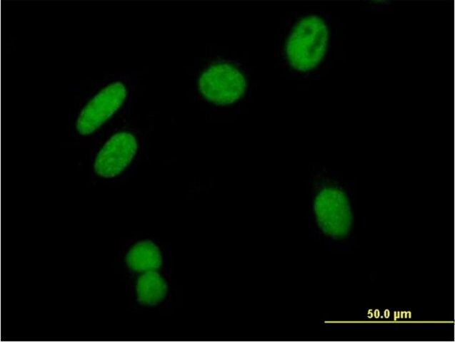 Anti-ZSCAN16 antibody produced in mouse