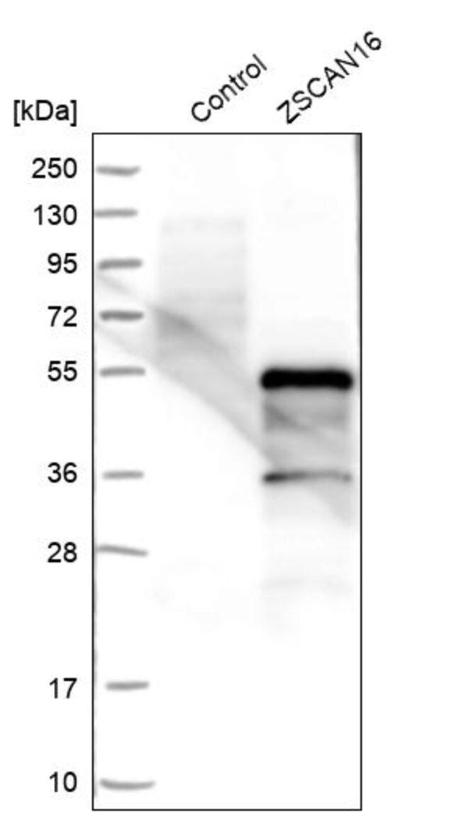 Anti-ZSCAN16 antibody produced in rabbit