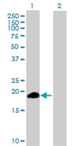 Anti-ZSCAN1 antibody produced in mouse