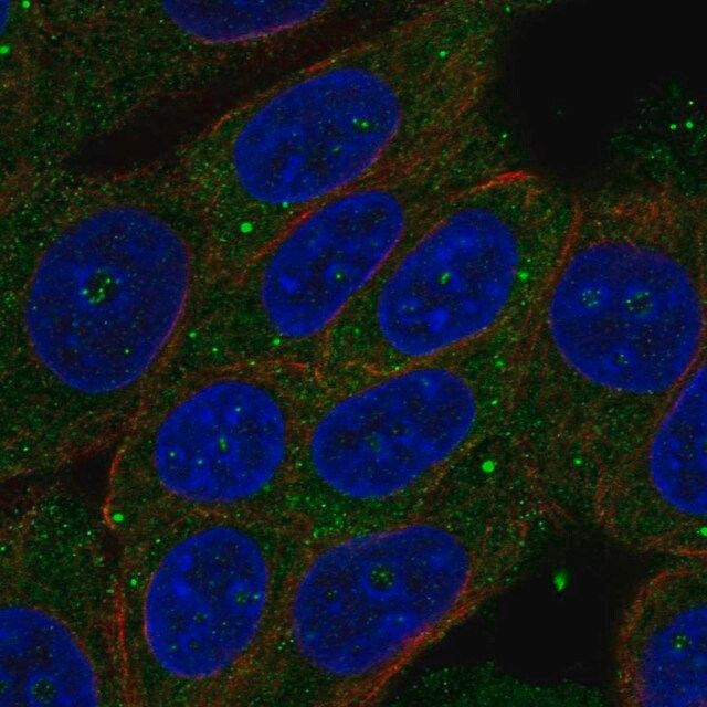 Anti-ZSWIM3 antibody produced in rabbit