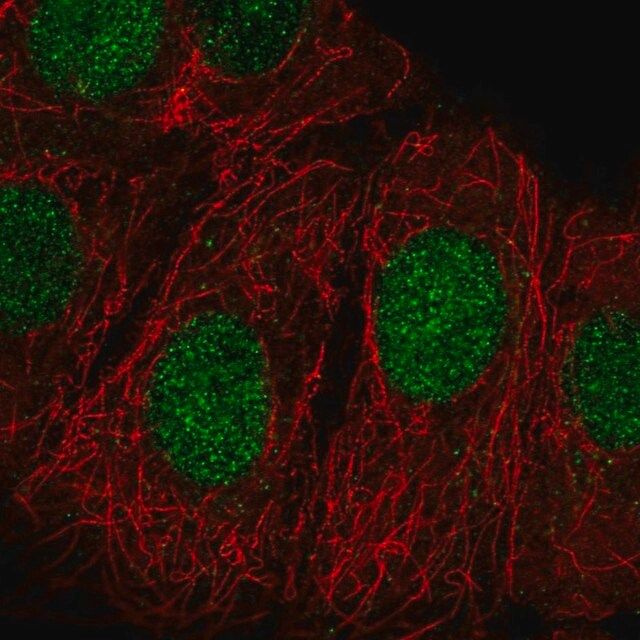 Anti-ZRANB3 antibody produced in rabbit