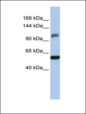 Anti-ZSCAN20 antibody produced in rabbit