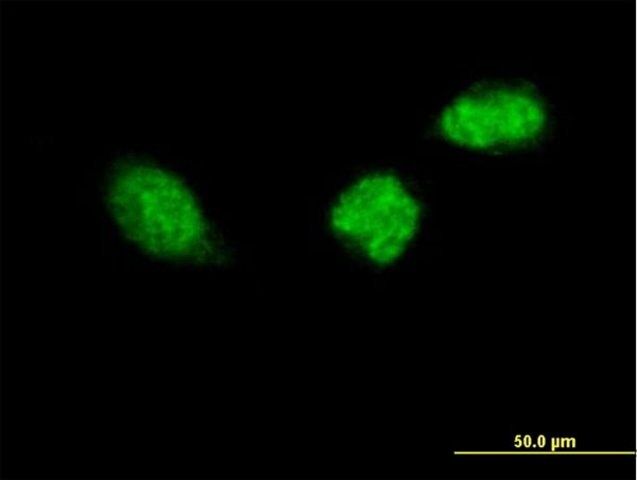 Anti-ZWINT antibody produced in mouse