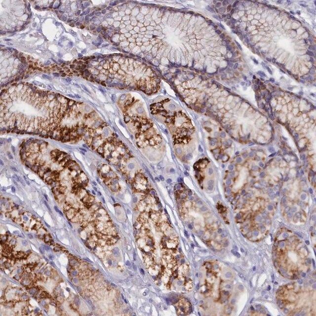 Anti-ZSWIM4 antibody produced in rabbit