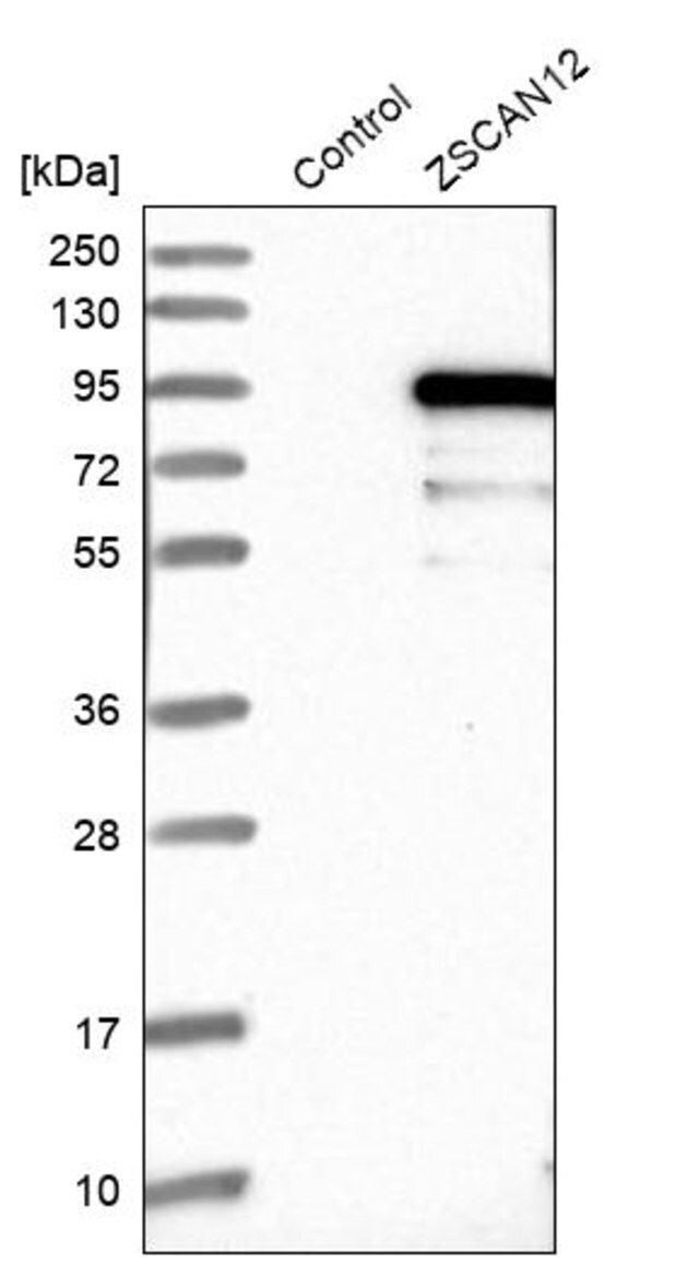 Anti-ZSCAN12 antibody produced in rabbit