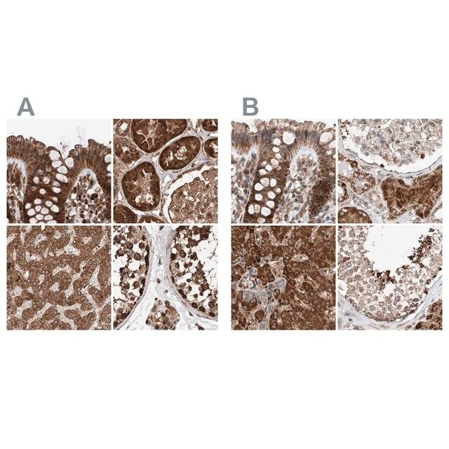 Anti-ZSCAN29 antibody produced in rabbit