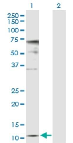 Anti-ZNRD1 antibody produced in rabbit