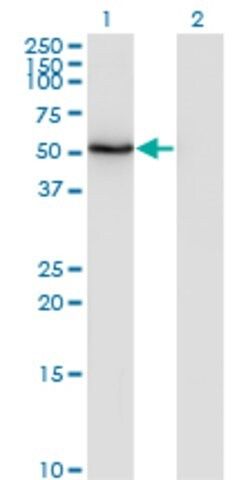 ANTI-ZSCAN21 antibody produced in mouse