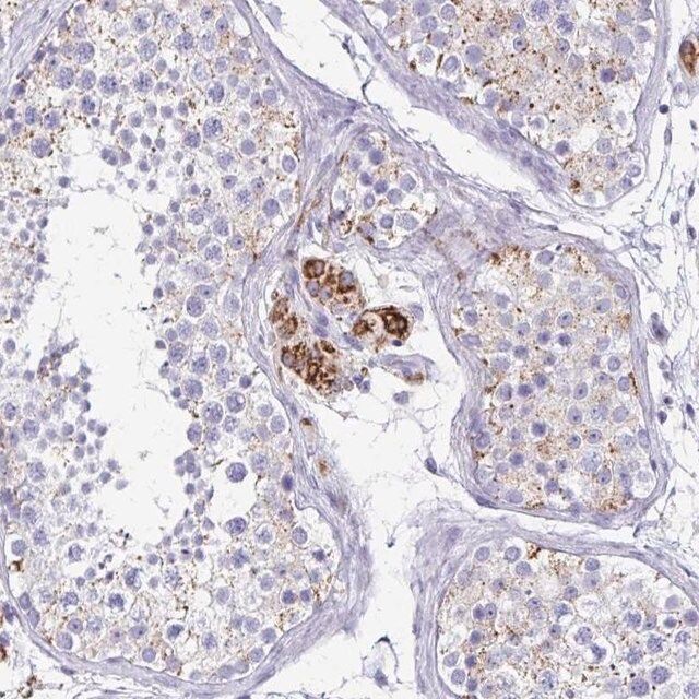 Anti-ZSCAN5B antibody produced in rabbit