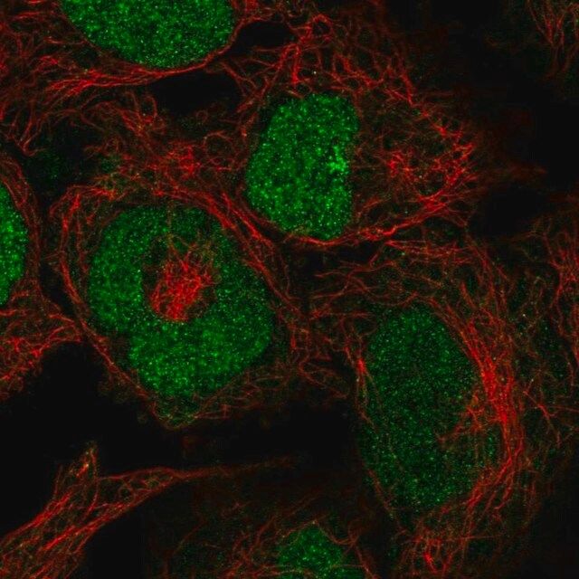 Anti-ZRANB2 antibody produced in rabbit