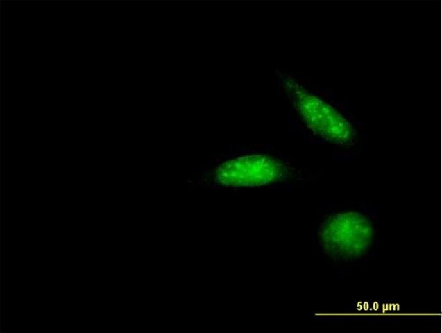 Anti-ZSCAN18 antibody produced in mouse