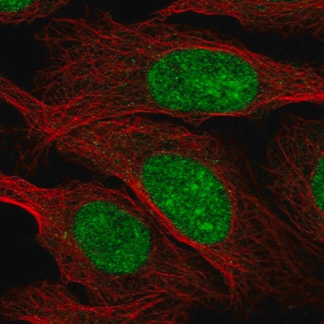 Anti-ZZZ3 antibody produced in rabbit