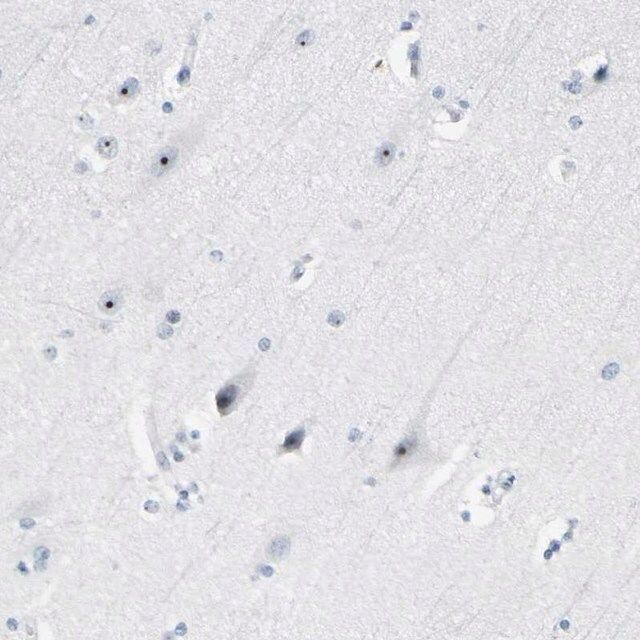 Anti-ZSCAN1 antibody produced in rabbit