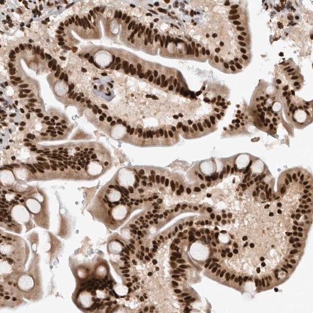 Anti-ZSCAN2 antibody produced in rabbit