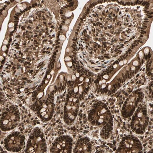 Anti-ZSCAN30 antibody produced in rabbit