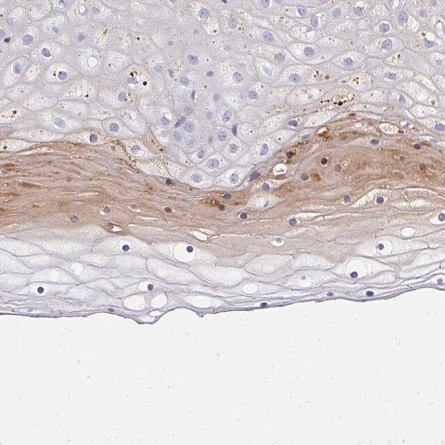 Anti-ZSWIM3 antibody produced in rabbit