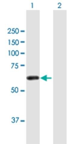 ANTI-ZSCAN21 antibody produced in mouse