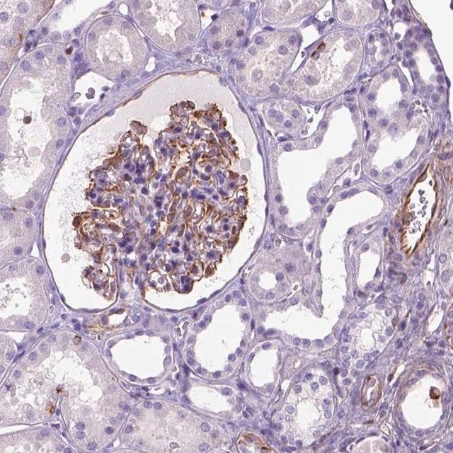 Anti-ZZZ3 antibody produced in rabbit