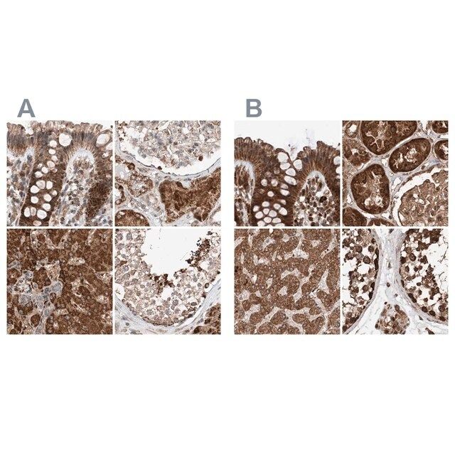 Anti-ZSCAN29 antibody produced in rabbit