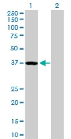 Anti-ZWINT antibody produced in rabbit