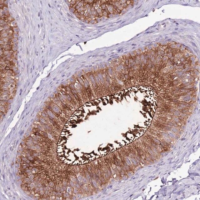 Anti-ZSWIM1 antibody produced in rabbit