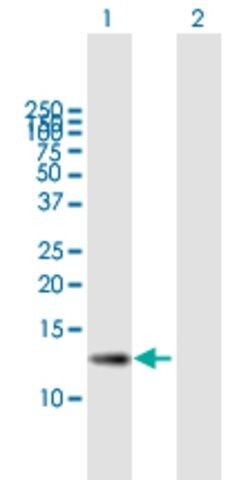 ANTI-ZSWIM7 antibody produced in mouse