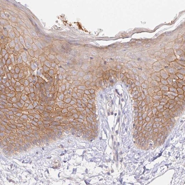 Anti-ZDHHC11B antibody produced in rabbit