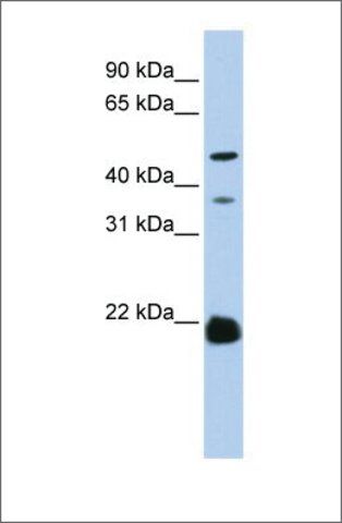 Anti-ZDHHC14 antibody produced in rabbit