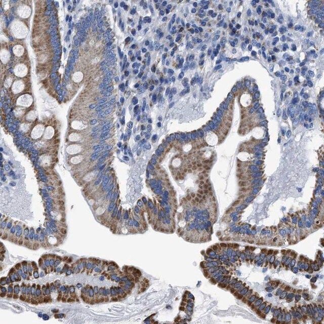 Anti-ZDHHC3 antibody produced in rabbit