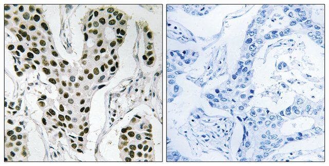 Anti-ZC3H4 antibody produced in rabbit