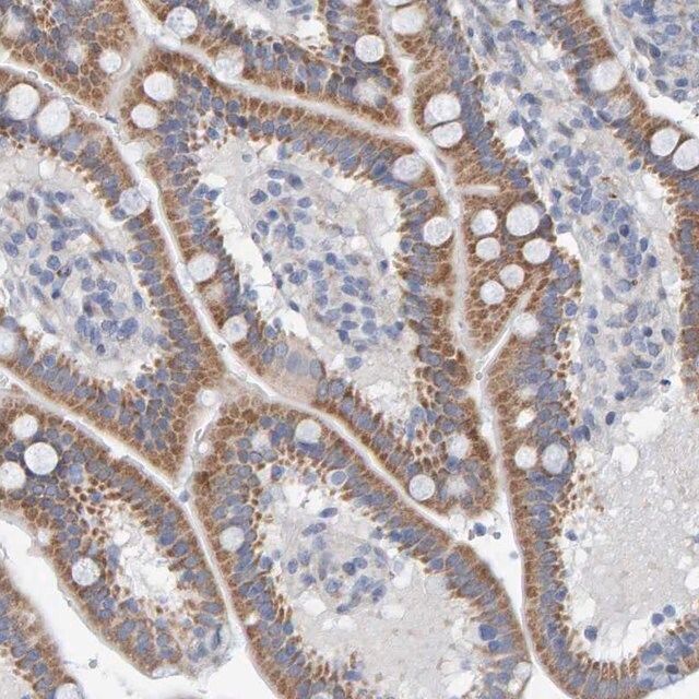 Anti-ZC3H3 antibody produced in rabbit