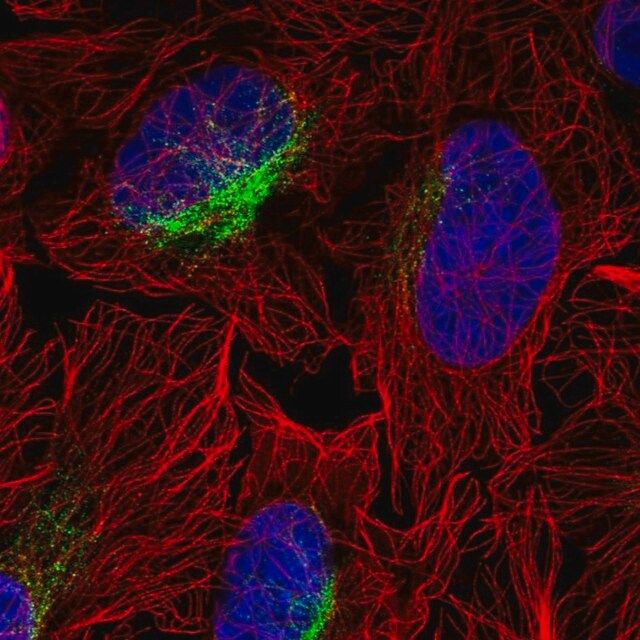 Anti-ZCCHC9 antibody produced in rabbit