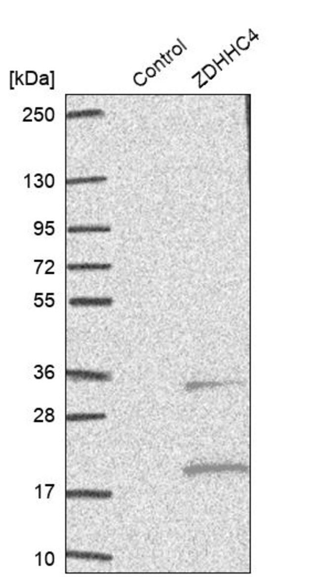 Anti-ZDHHC4 antibody produced in rabbit