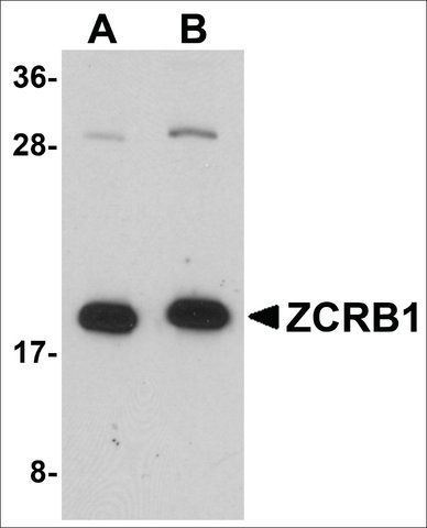 Anti-ZCRB1 antibody produced in rabbit