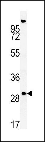 ANTI-ZDHHC21 (N-TERM) antibody produced in rabbit