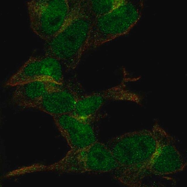 Anti-ZC3H6 antibody produced in rabbit