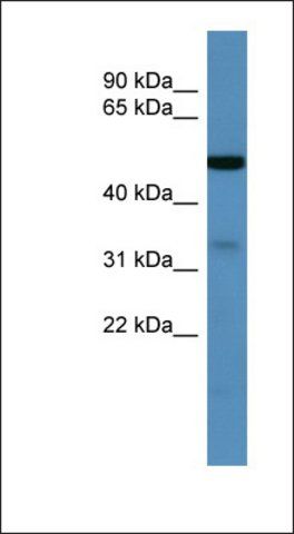 Anti-ZDHHC3 antibody produced in rabbit